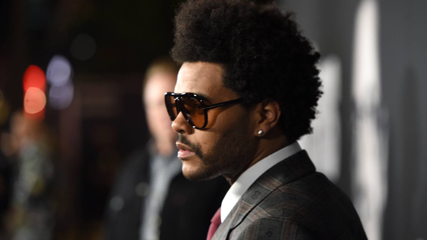 The Weeknd reveals the truth behind recent photos of his broken nose and  busted lip – KISS 104.1 FM